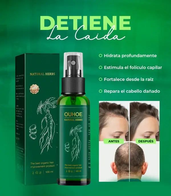 ¡Recupera tu Cabello con Nuestro Ouhoe Tónico Capilar!Natural y Sin Efectos Secundarios y Lo Mejor de Todo Paga 1 y Lleva 2