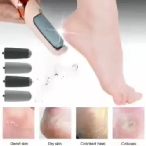 Quita Callos Eléctrico – Pies Suaves en Casa, Sin Gastar en Salones