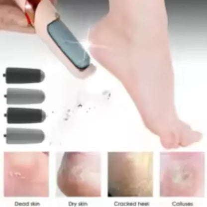 Quita Callos Eléctrico – Pies Suaves en Casa, Sin Gastar en Salones