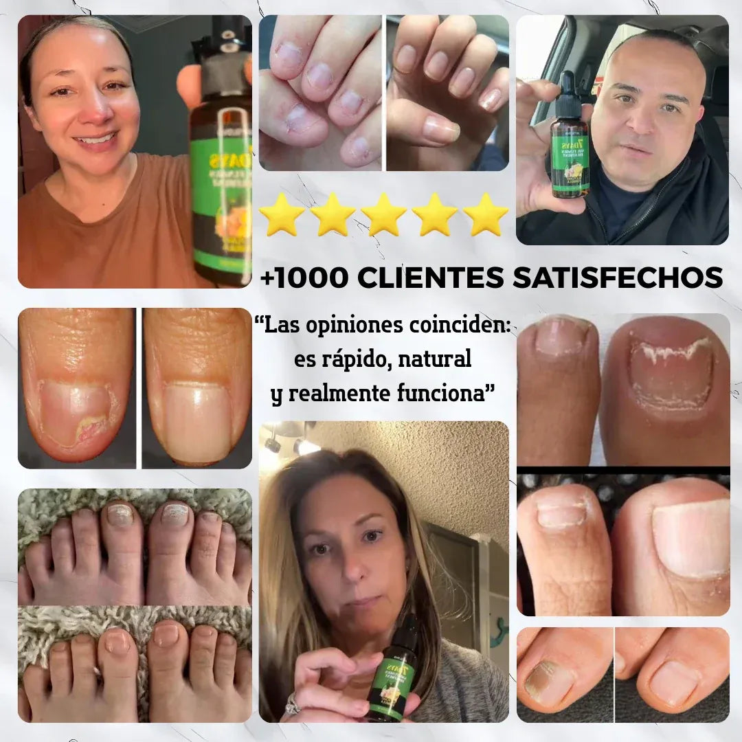 7 Days Antihongos y Fortalecedor de Uñas – Uñas limpias, fuertes y con brillo natural