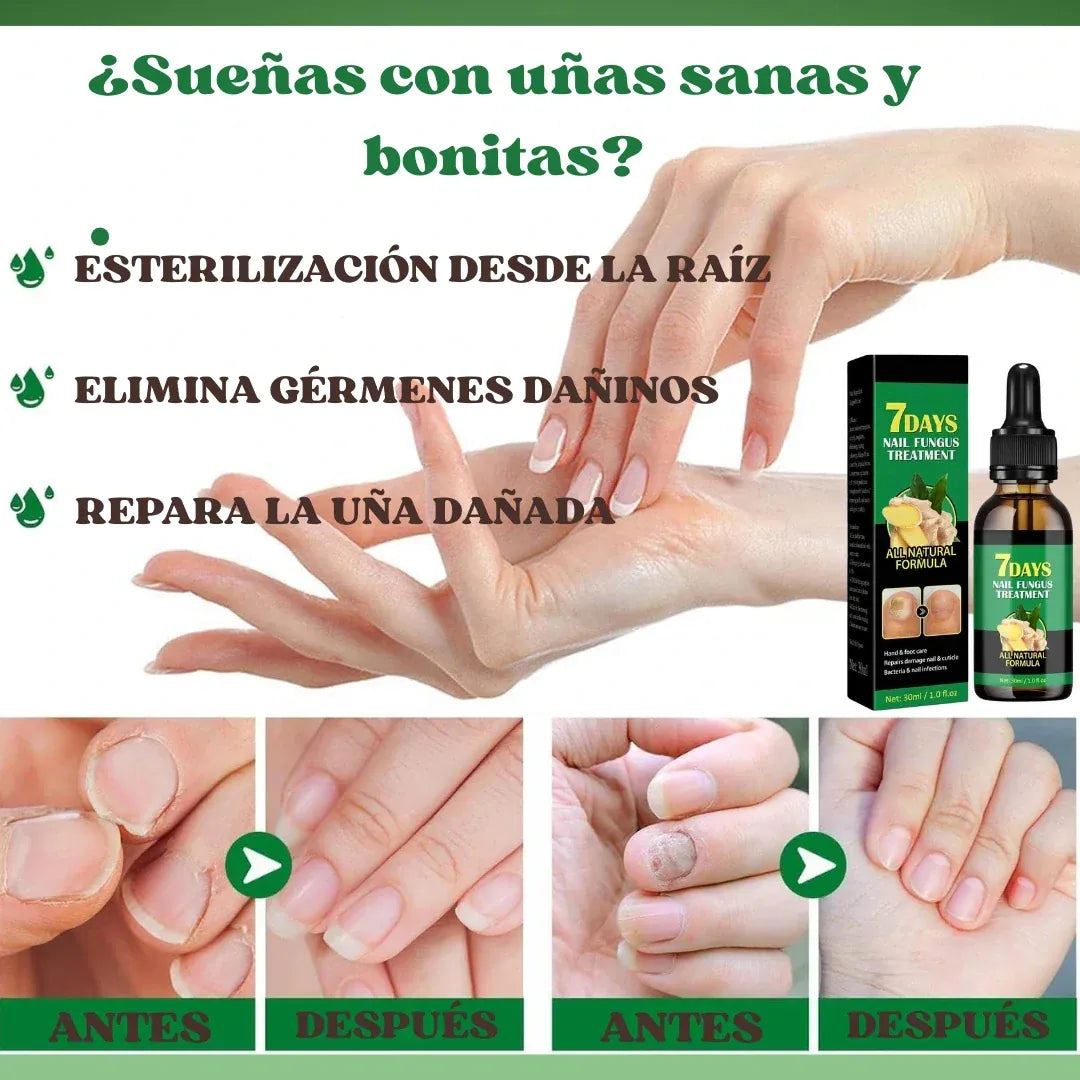 7 Days Antihongos y Fortalecedor de Uñas – Uñas limpias, fuertes y con brillo natural