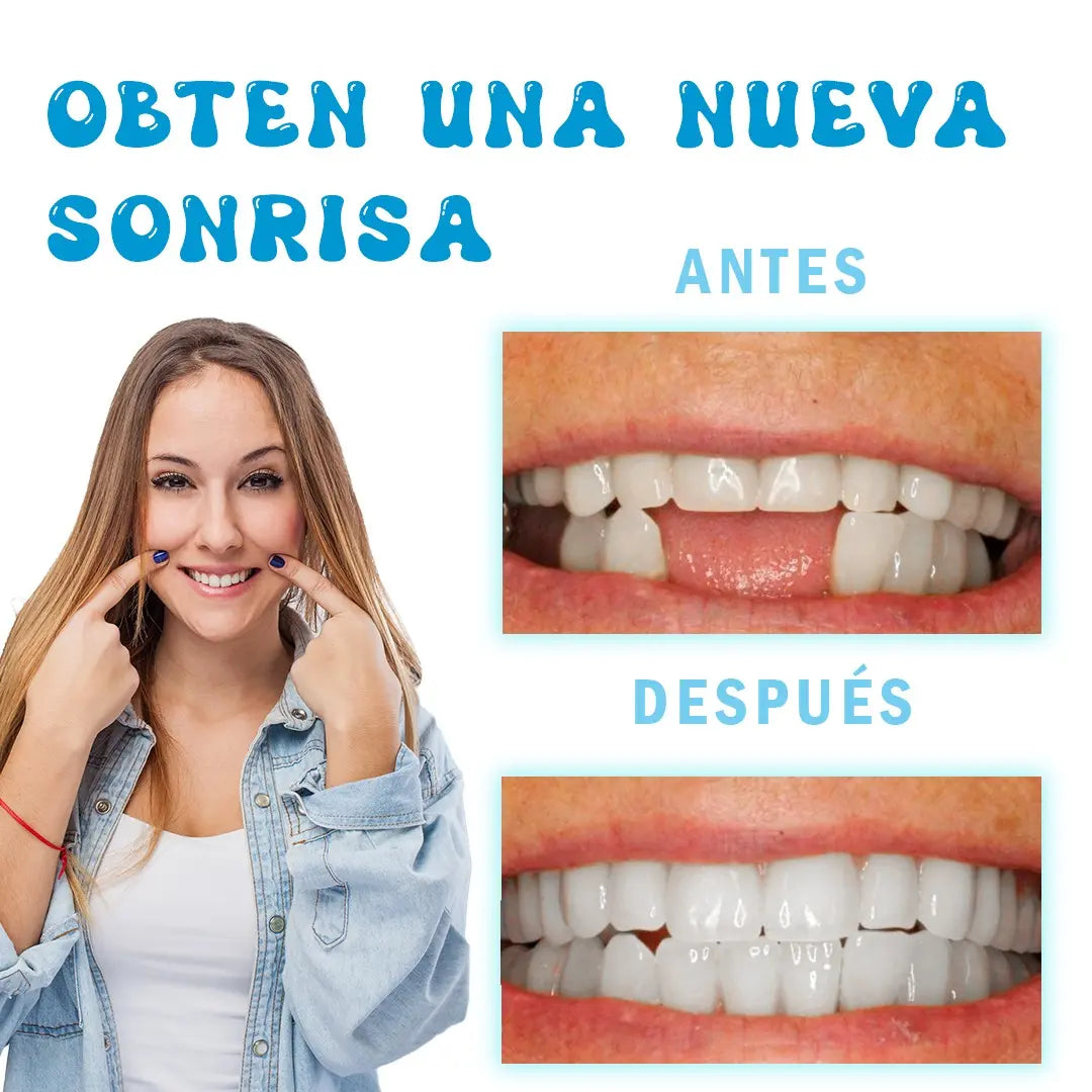 Molde para Dentadura de Resina – Recupera tu Sonrisa al Instante y con Seguridad