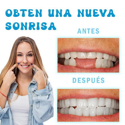 Molde para Dentadura de Resina – Recupera tu Sonrisa al Instante y con Seguridad
